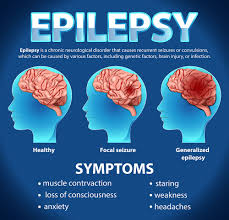 Living With Epilepsy